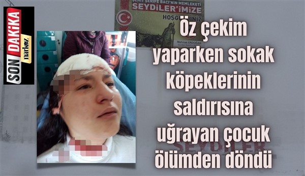 Köpeklerin saldırdığı çocuğu belediye temizlik personeli kurtardı