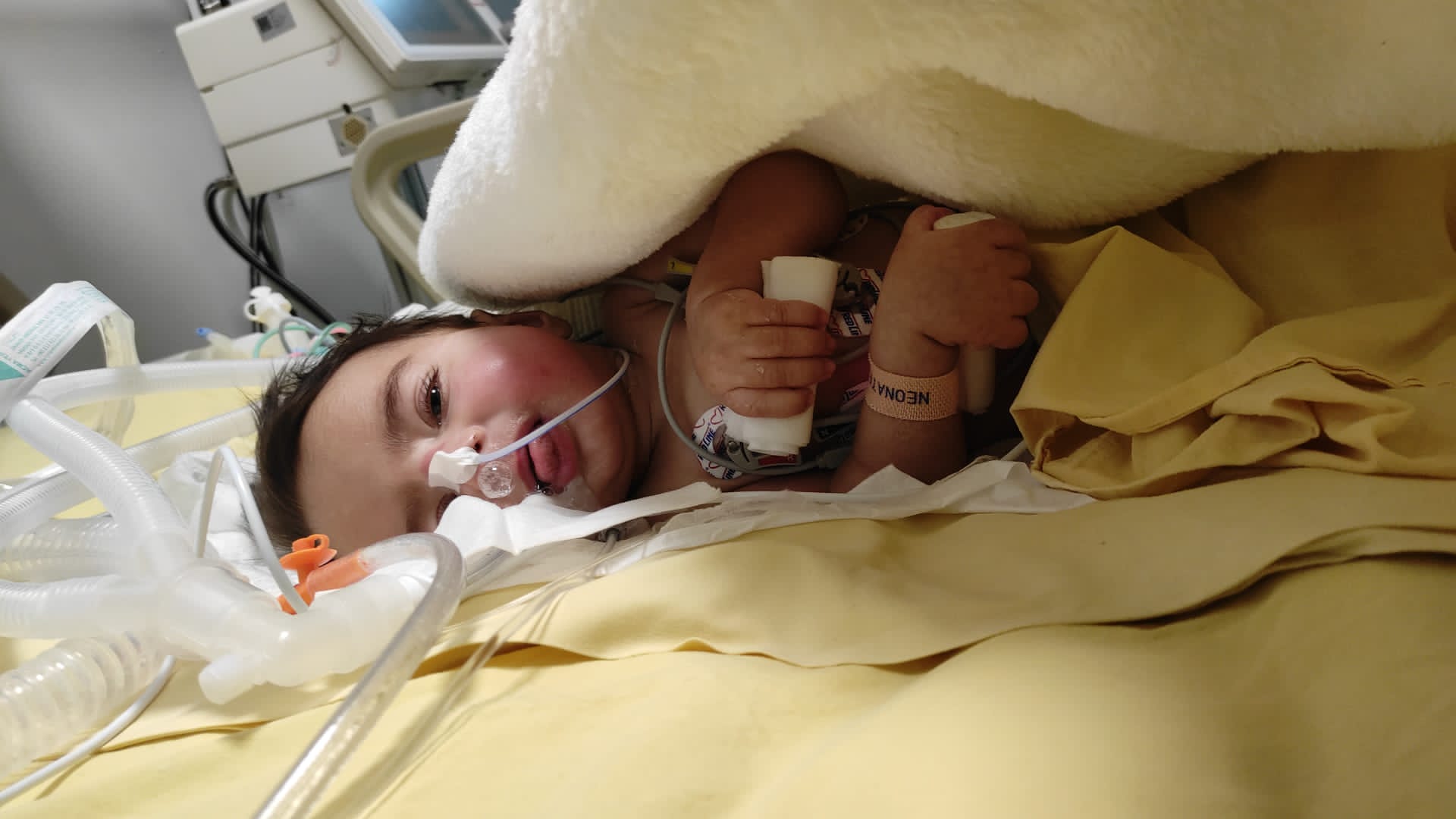 SMA TİP-1 Ölümcül kas hastası Dua İkra bebek desteklerinizi bekliyor