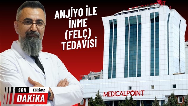 Anjiyo ile inme (felç)  tedavisi 