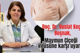 Doç. Dr. Vuslat Keçik Boşnak, Maymun Çiçeği virüsüne karşı uyardı