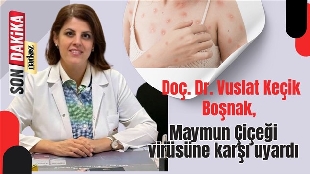 Doç. Dr. Vuslat Keçik Boşnak, Maymun Çiçeği virüsüne karşı uyardı