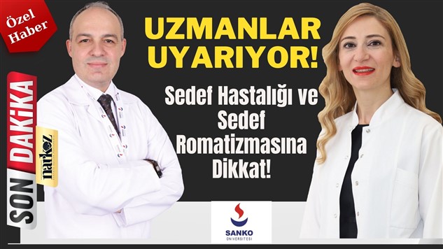 Sedef Hastalığı ve Sedef Romatizmasına Dikkat!