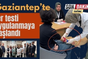 Gaziantep Şehir Hastanesi, gaziantep haberler, ter testi