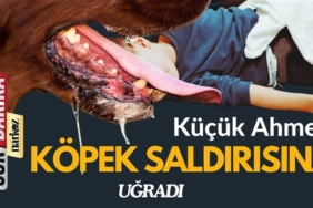 gaziantep haberler, son dakika, narkoz haber