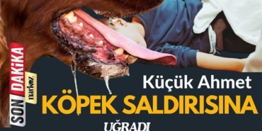 gaziantep haberler, son dakika, narkoz haber