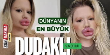 Dünyanın en büyük dudaklı kadını Andrea Ivanova