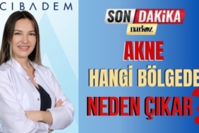 Akne Hangi Bölgede Neden Çıkar?