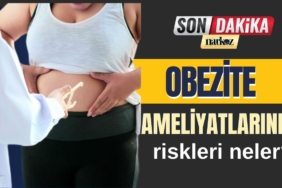 Obezite ameliyatına karar vermeden önce mutlaka bilinmesi gerekenler…