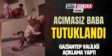 Çocuğuna Şiddet Uygulayan Acımasız Baba Tutuklandı