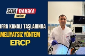 Safra Kanalı Taşlarında Ameliyatsız Yöntem ERCP