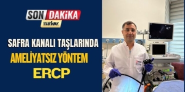 Safra Kanalı Taşlarında Ameliyatsız Yöntem ERCP