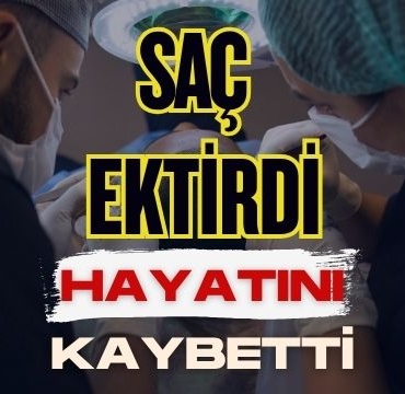 Saç Ektirdi Hayatını Kaybetti