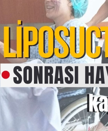 Liposuction Sonrası Hayatını Kaybetti