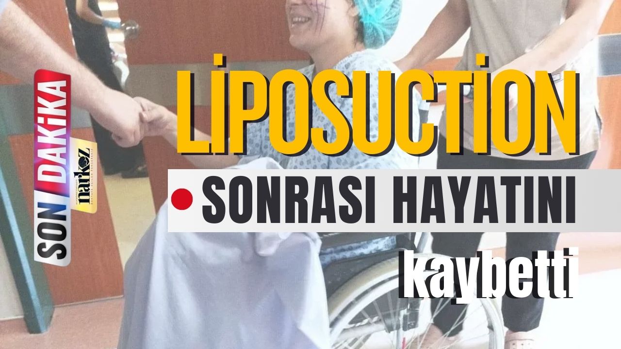 Liposuction Sonrası Hayatını Kaybetti
