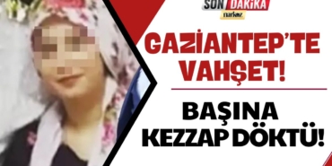 Gaziantep'te Vahşet Boşanma Aşamasındaki Eşine İşkence Yapıp Başına Kezzap Döktü!
