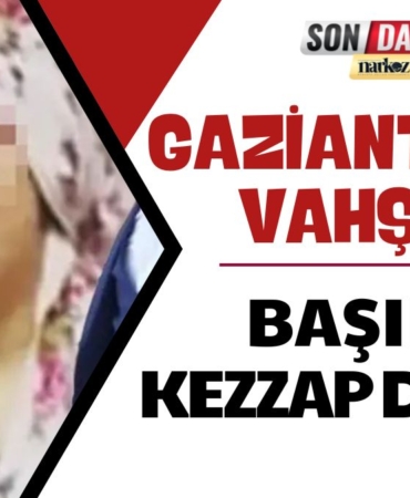 Gaziantep'te Vahşet Boşanma Aşamasındaki Eşine İşkence Yapıp Başına Kezzap Döktü!