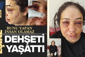 Adalet Bu Morlukların Neresinde? Polis, Eşine Dehşeti Yaşattı