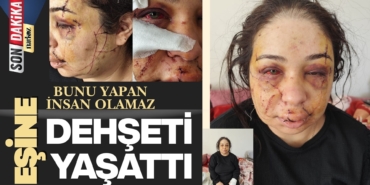 Adalet Bu Morlukların Neresinde? Polis, Eşine Dehşeti Yaşattı