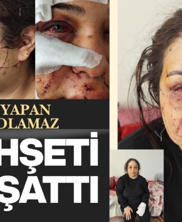 Adalet Bu Morlukların Neresinde? Polis, Eşine Dehşeti Yaşattı