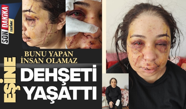 Adalet Bu Morlukların Neresinde? Polis, Eşine Dehşeti Yaşattı