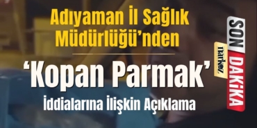Adıyaman İl Sağlık Müdürlüğü’nden ‘Kopan Parmak’ İddialarına İlişkin Açıklama