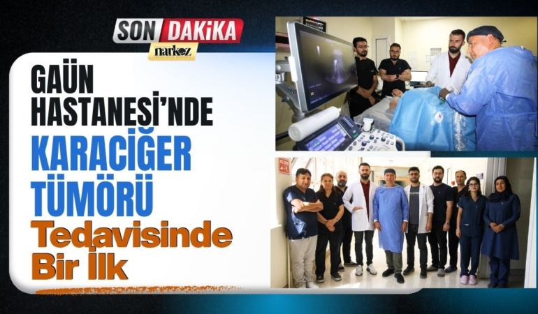 GAÜN Hastanesi’nde Karaciğer Tümörü Tedavisinde Bir İlk