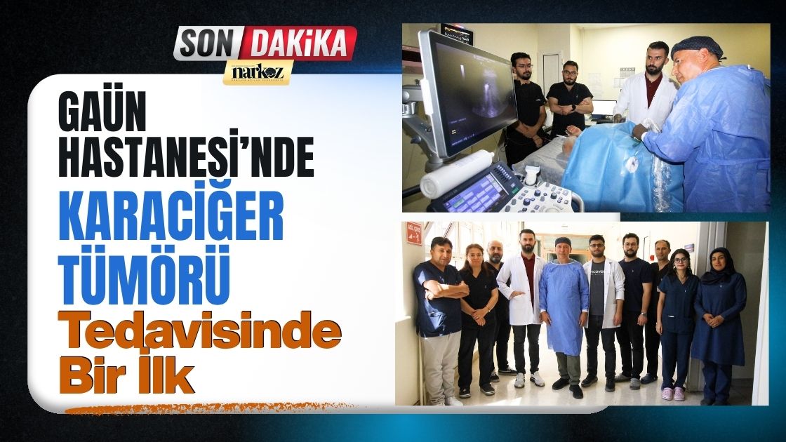 GAÜN Hastanesi’nde Karaciğer Tümörü Tedavisinde Bir İlk