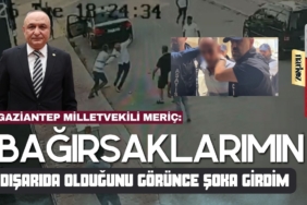 Gaziantep’te Toz Bulutu Alarmı: Kuzey Afrika’dan Gelen Fırtına Şehri Esir Aldı!
